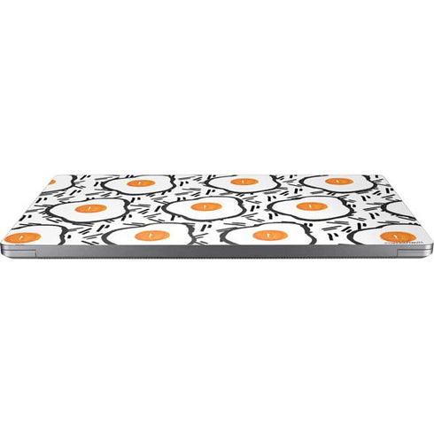 Bouffants and Broken Hearts Eggs Universal Laptop 16.6in (13.4 x 9.7in) Skin